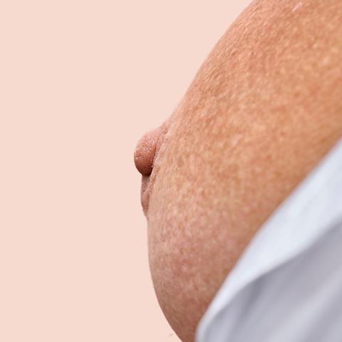 Tepelinstituut - tepelprotheses