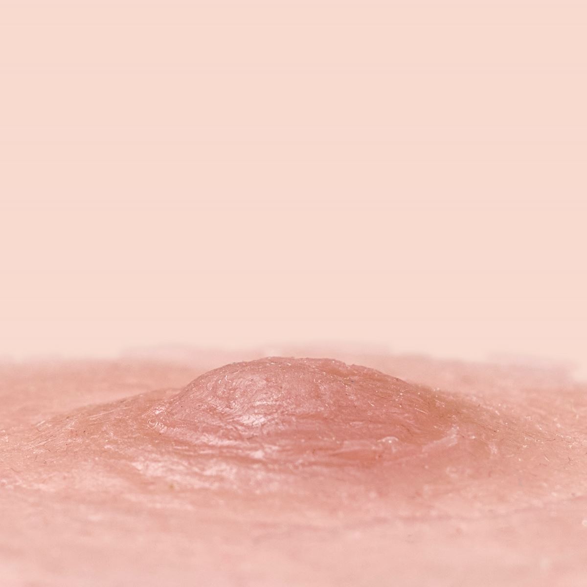 Tepelprotheses soft roze