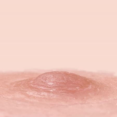 standaard tepelprothesen 2mm