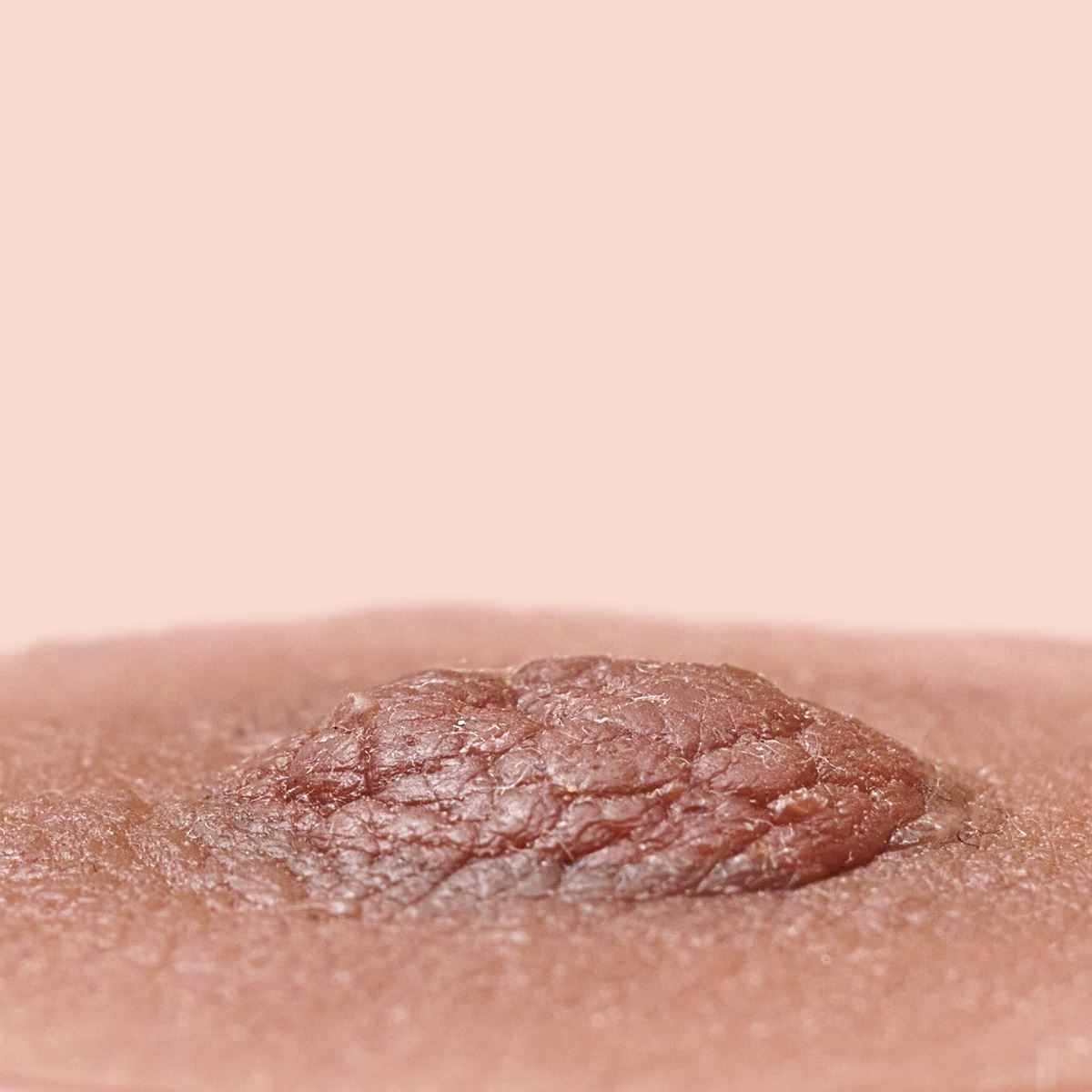 Tepelprotheses chocolat