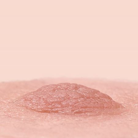 3mm standaard tepelprothesen