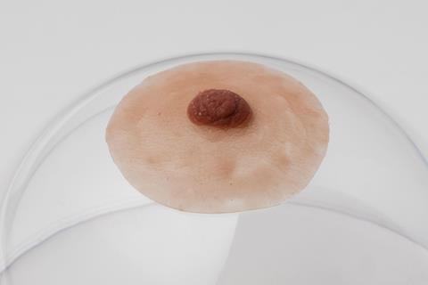 tepelprotheses tepels