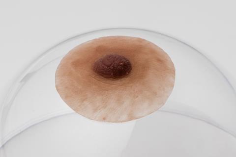 tepelprotheses tepels