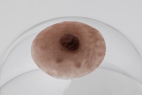 tepelprotheses tepels