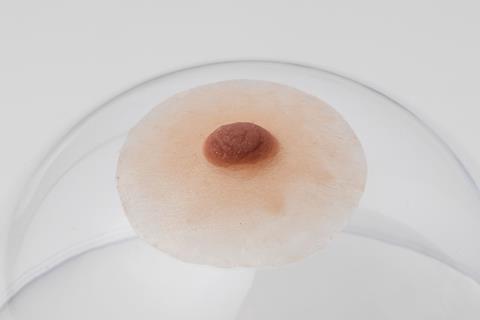 tepelprotheses tepels