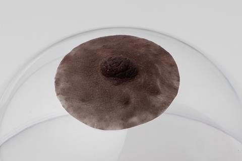 tepelprotheses tepels