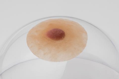 tepelprotheses tepels